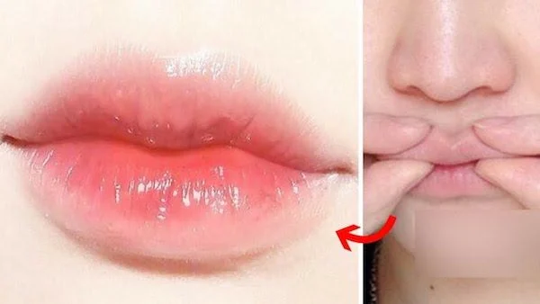 Tạo hình môi tim