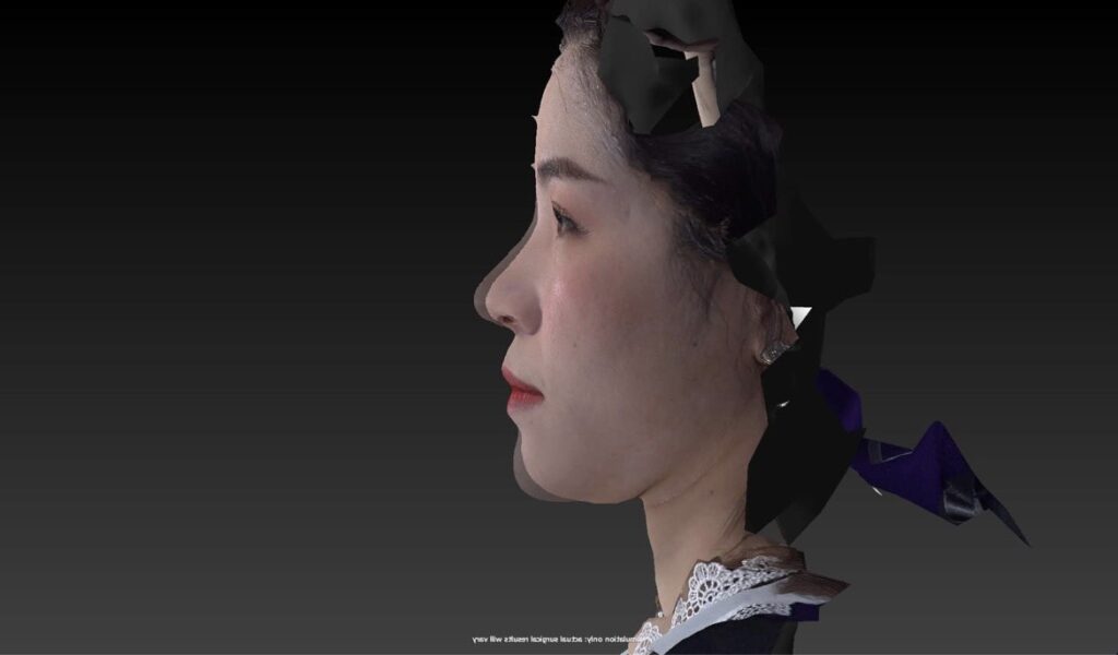 mô phỏng bằng công nghệ Vectra XT3D