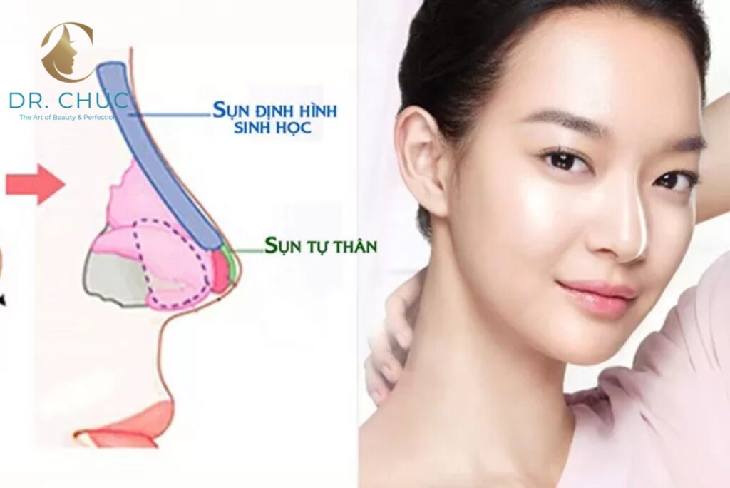 Cách duy trì hiệu quả nâng mũi lâu dài