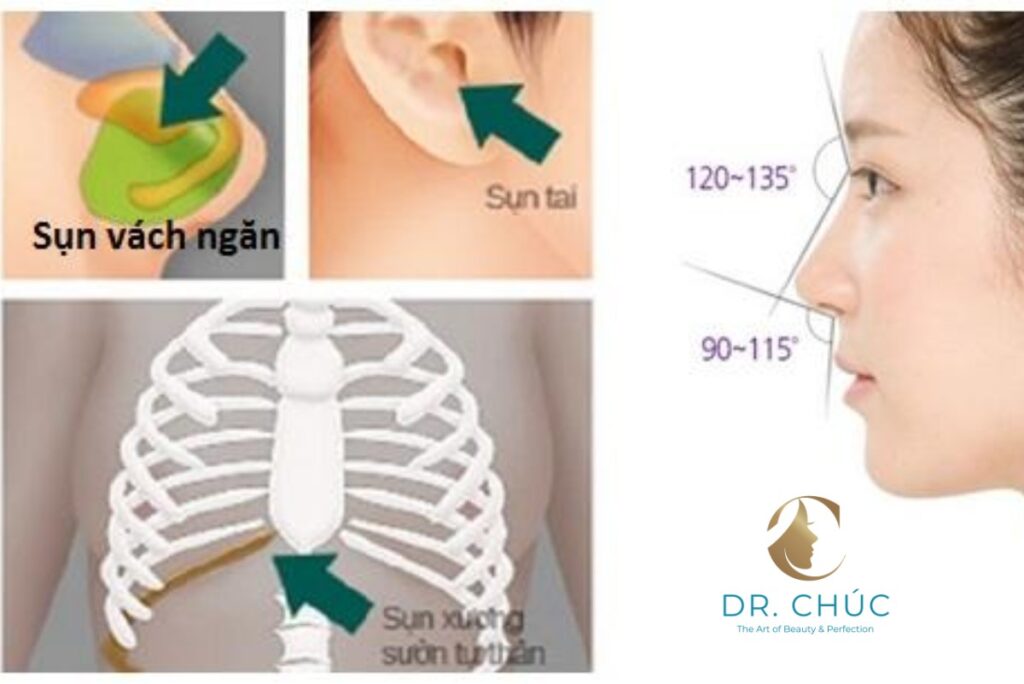 Chế Độ Dinh Dưỡng Khoa Học Sau Nâng Mũi