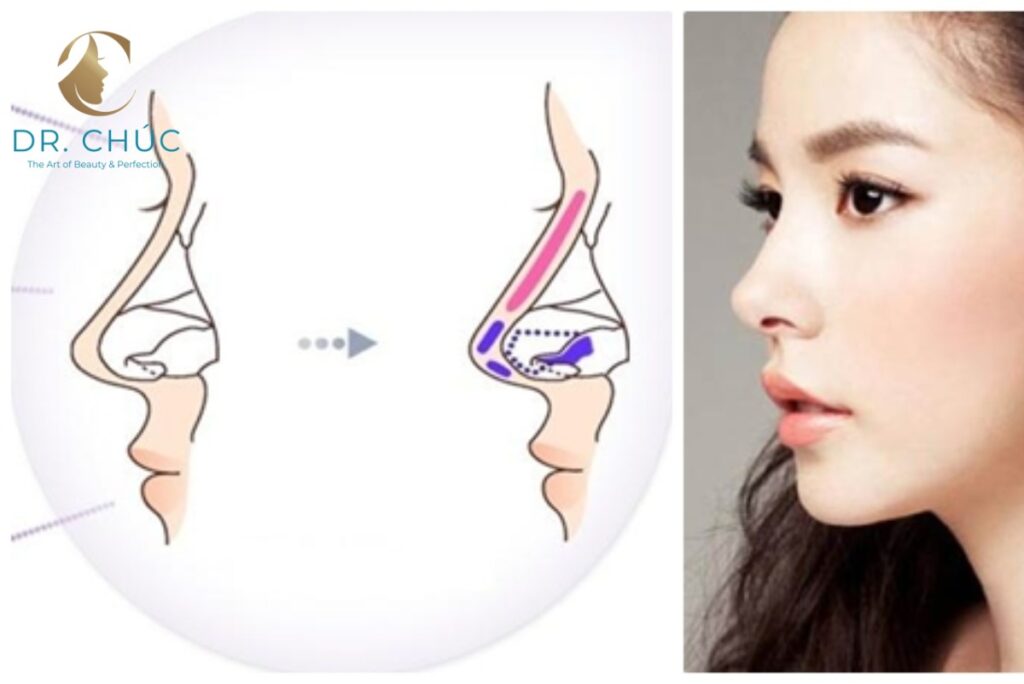 Dấu Hiệu Cần Báo Ngay Cho Bác Sĩ