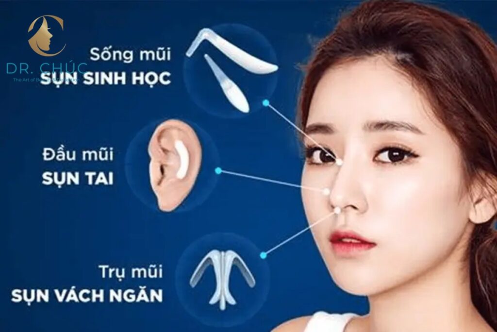 Nâng mũi cấu trúc là gì? Vì sao được ưa chuộng