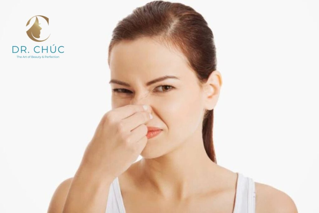Cách xử lý tụ dịch sau nâng mũi hiệu quả