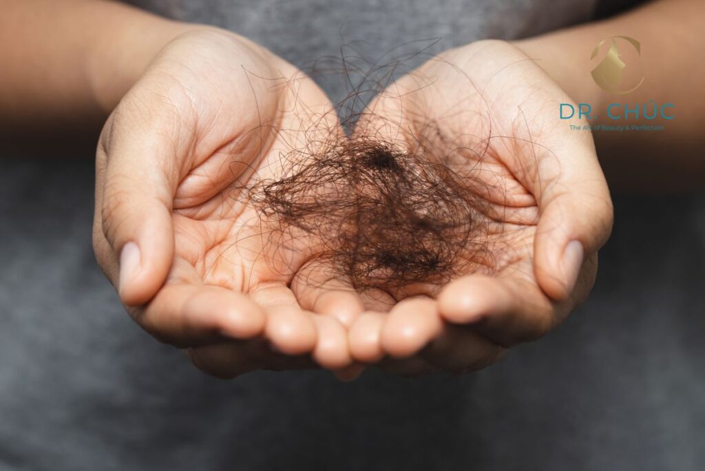 Dấu hiệu nhận biết mất cân bằng nội tiết tố gây rụng tóc