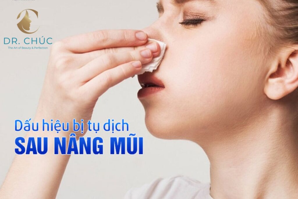 Dấu hiệu nhận biết tụ dịch sau nâng mũi