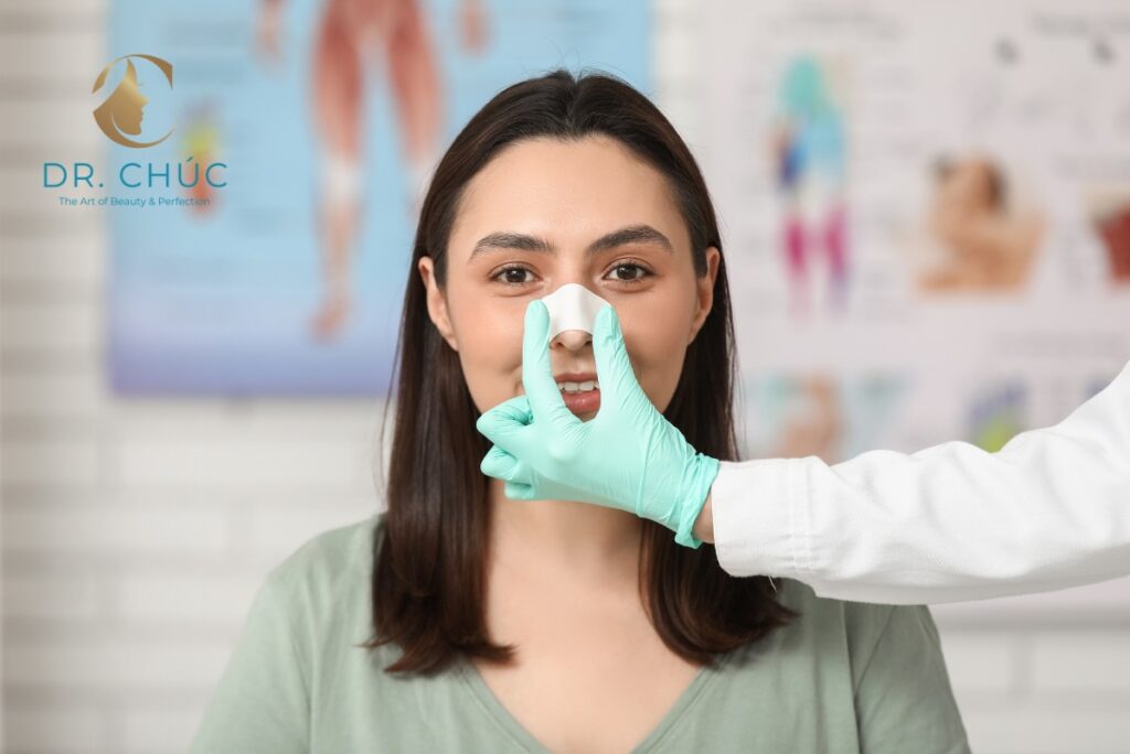 Nâng mũi cấu trúc bao lâu thì gom lại?