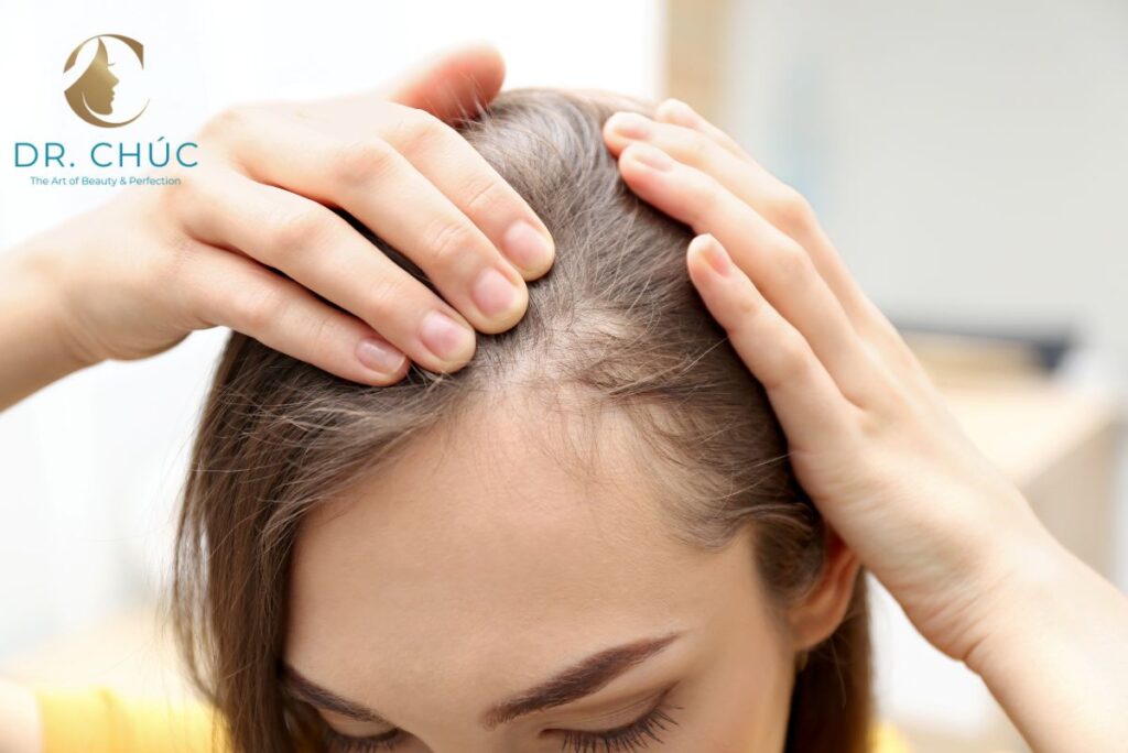 Vì sao mất cân bằng nội tiết tố gây rụng tóc?