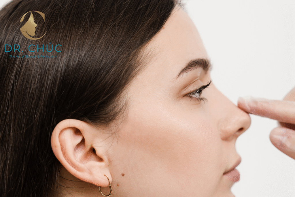 Vì sao vuốt mũi không thể làm mũi cao?