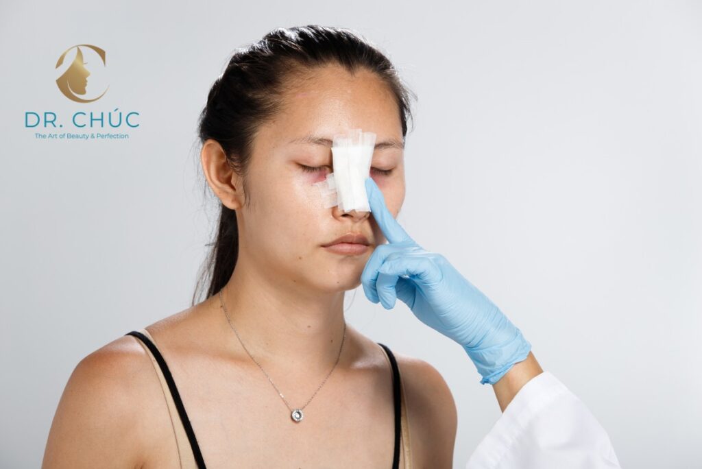 Yếu tố ảnh hưởng đến thời gian gom mũi