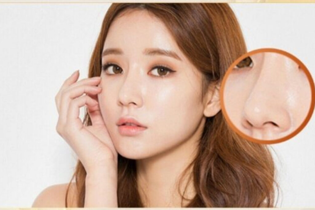 Giải mã câu hỏi: 16 tuổi có nên nâng mũi không?