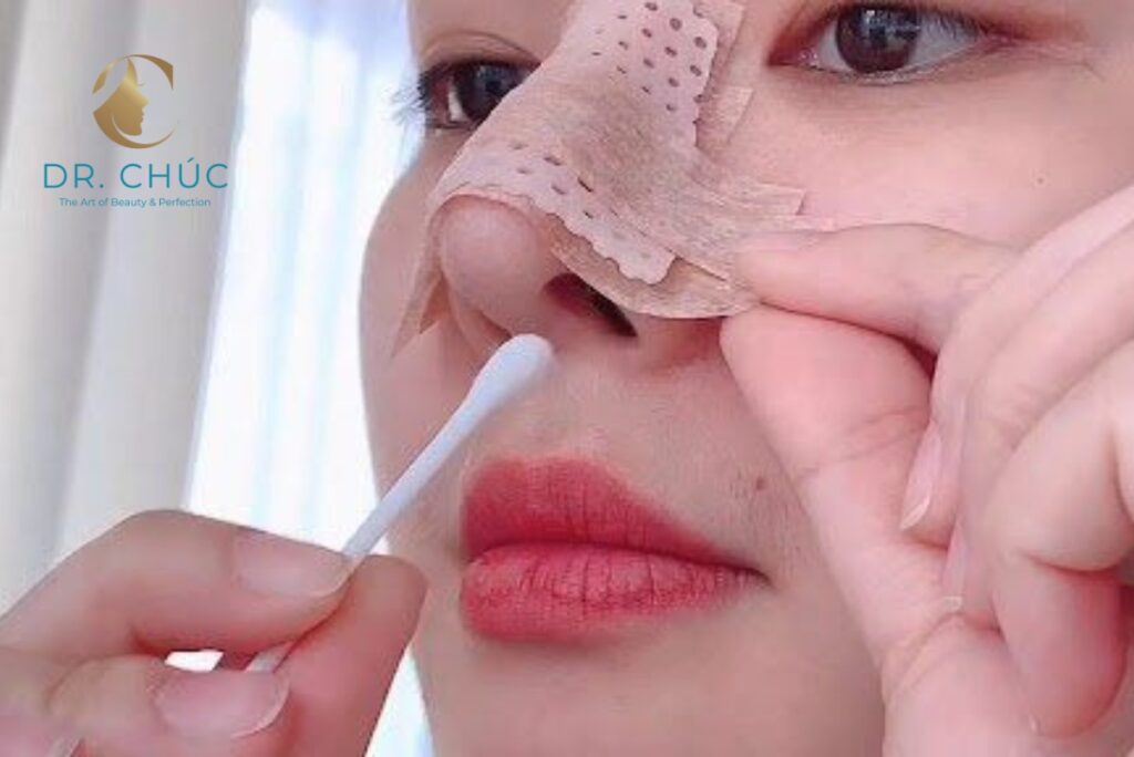 Cách xử lý biến chứng sau nâng mũi
