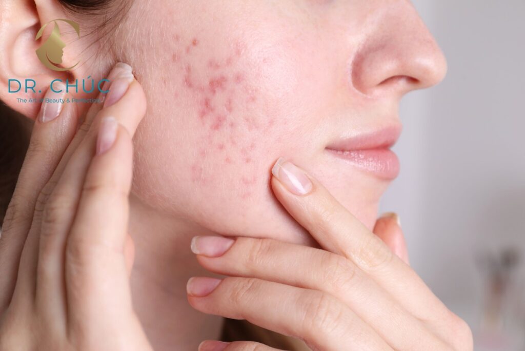 Khi nào nên gặp Bác sĩ Chúc để điều trị