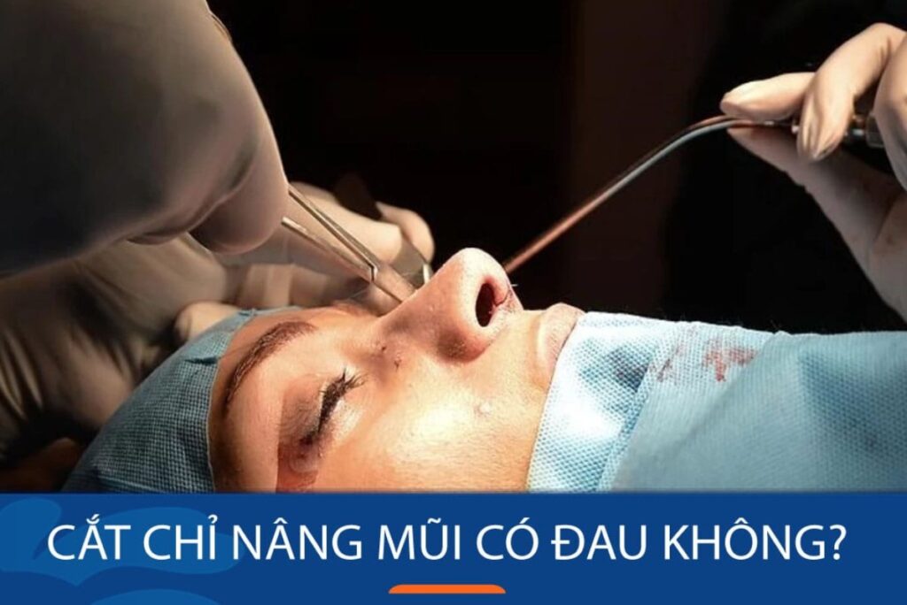 Vì sao tuyệt đối không nên tự cắt chỉ tại nhà