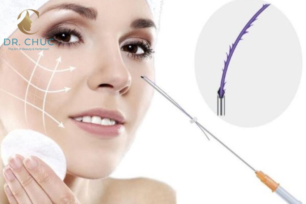 Công nghệ nâng mũi chỉ HIKO – Bí quyết dáng mũi chuẩn Hàn