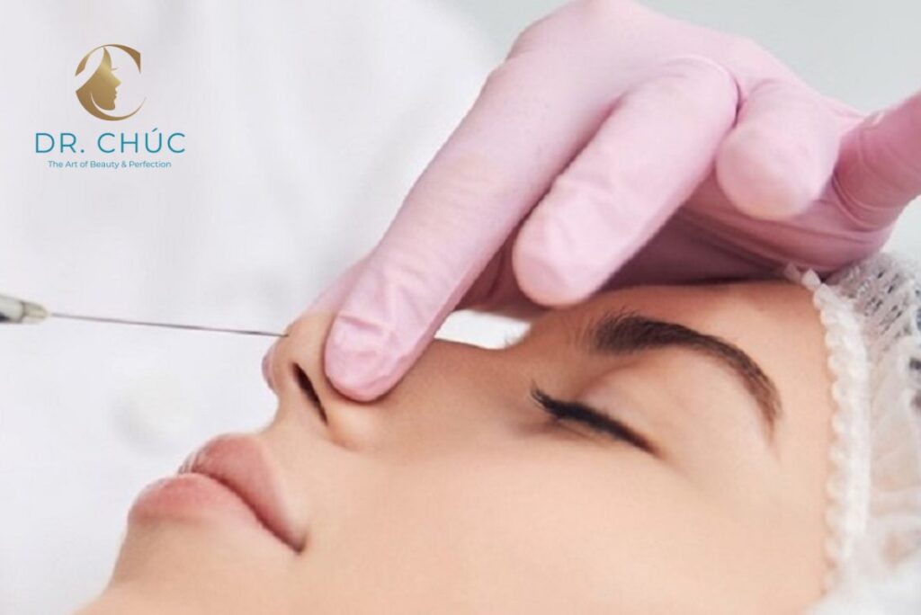 Quy trình thực hiện nâng mũi bằng chỉ