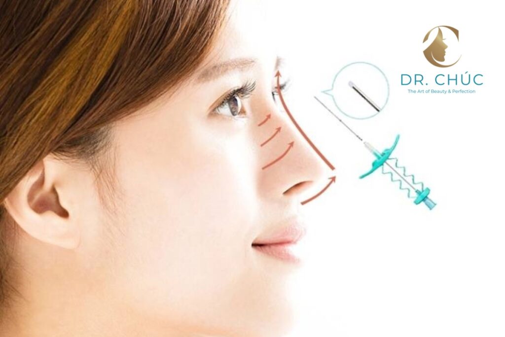 Nâng mũi bằng chỉ có nguy hiểm không?