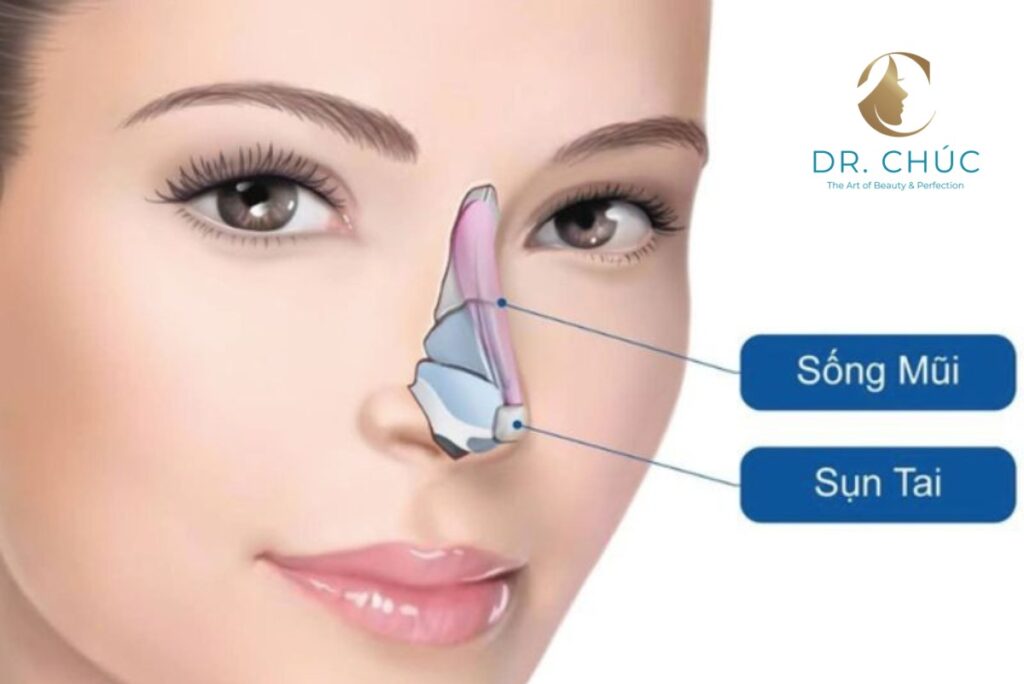Tư vấn thẩm mỹ mũi an toàn cùng Bác sĩ Chúc