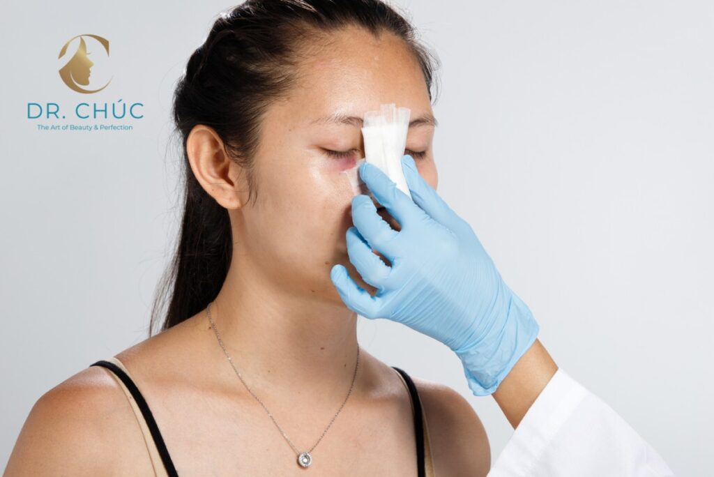 Nâng mũi chảy nước mũi có nguy hiểm không?