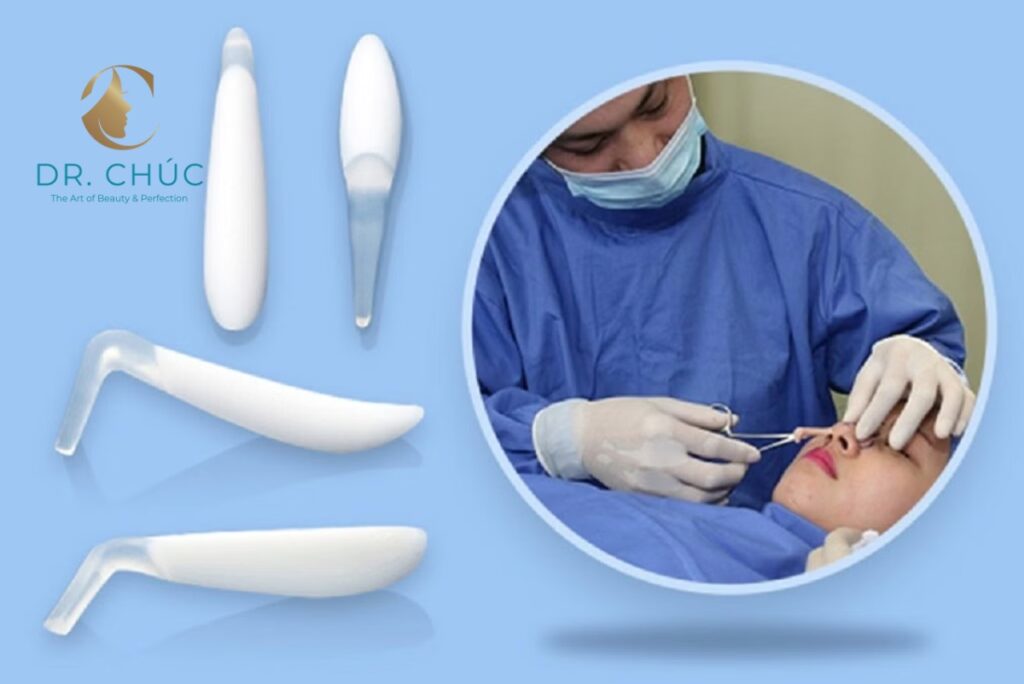 Tìm hiểu về nâng mũi sụn nhân tạo