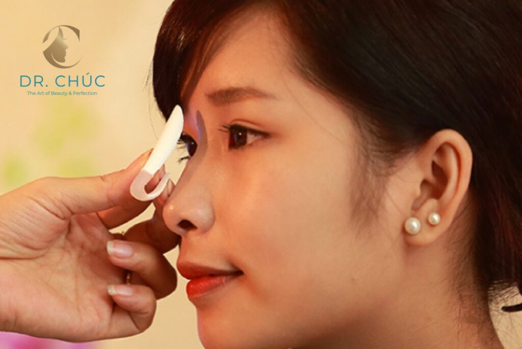 Lợi ích khi tái tạo dáng mũi bằng sụn nhân tạo sau gãy