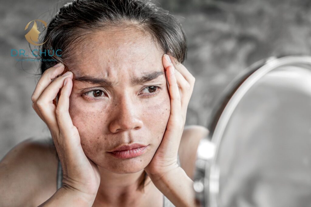 Khái niệm rối loạn nội tiết tố sau sinh