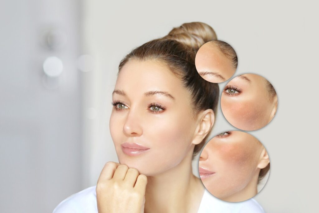 Vì sao rối loạn nội tiết tố sau sinh gây nám da?