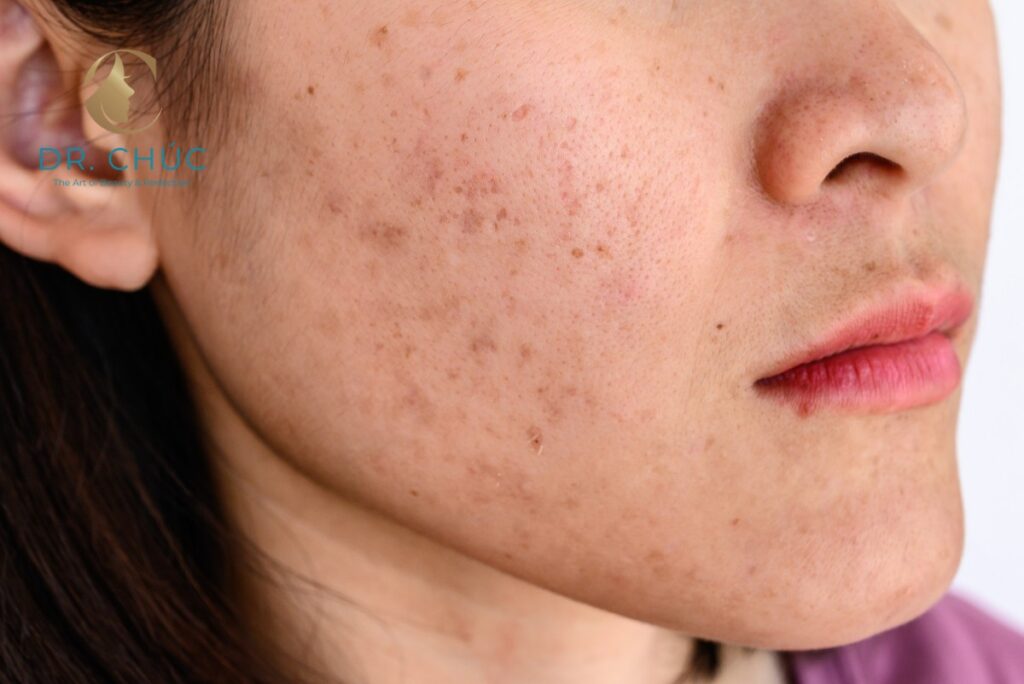 Nguyên nhân chính dẫn đến rối loạn nội tiết sau sinh