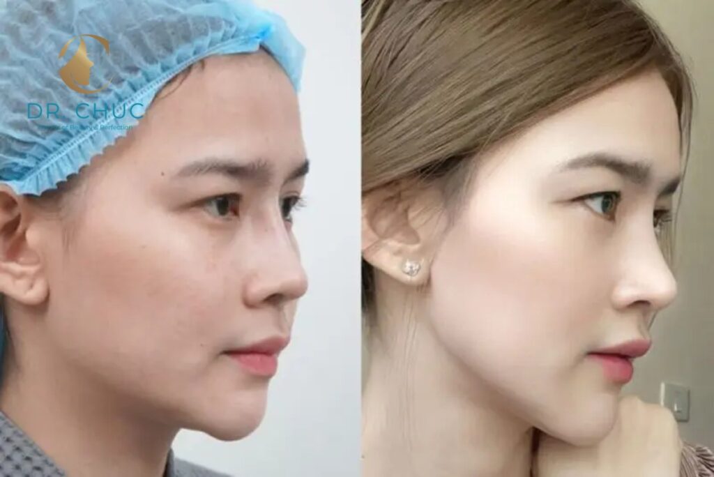 Các hướng xử trí theo mức độ