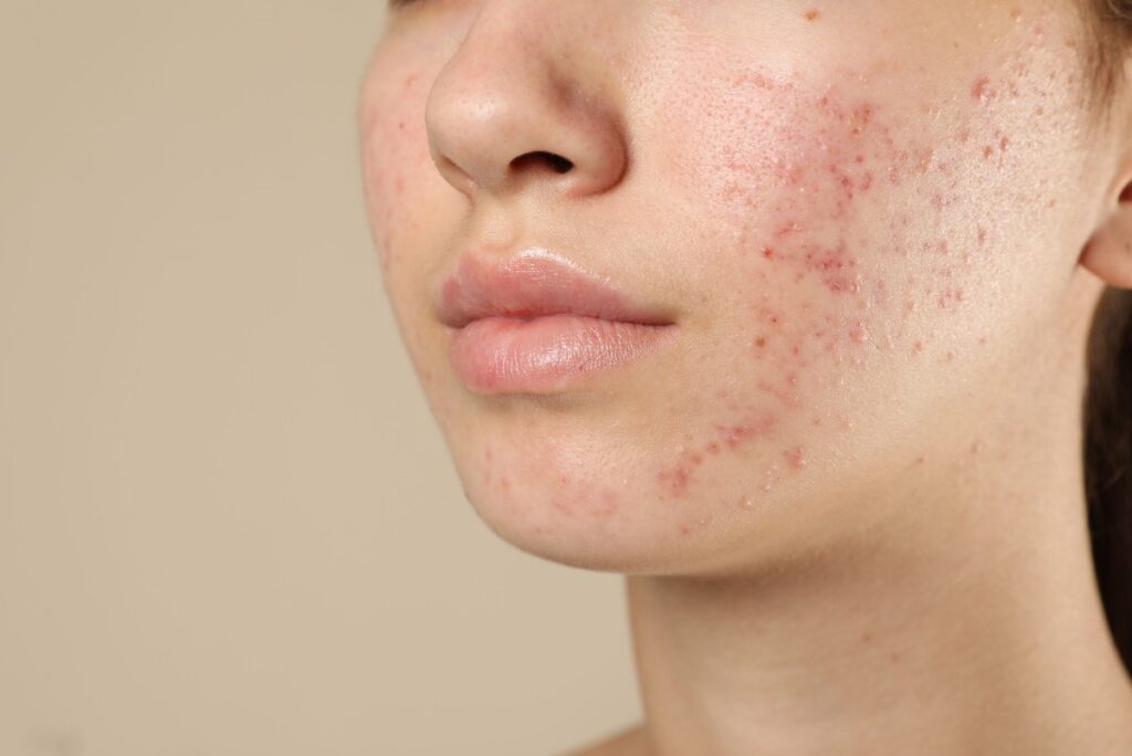 Vai trò của estrogen trong giai đoạn dậy thì