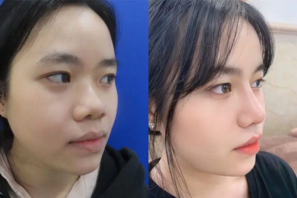 Lời khuyên từ Bác sĩ Chúc