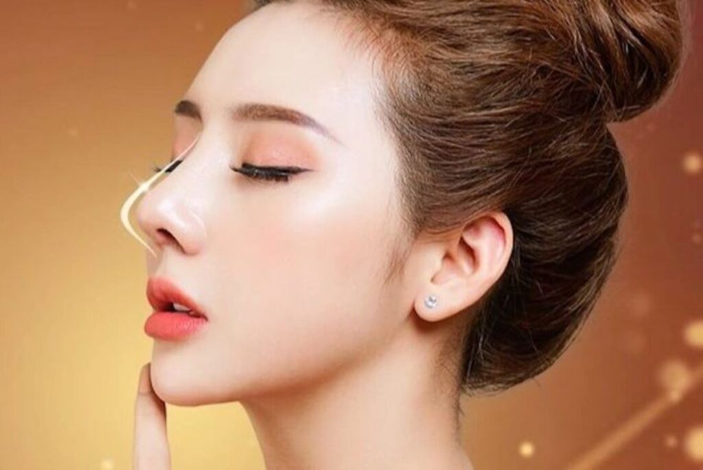 Có nên lo lắng khi nâng mũi bị nổi cục trong lỗ mũi?