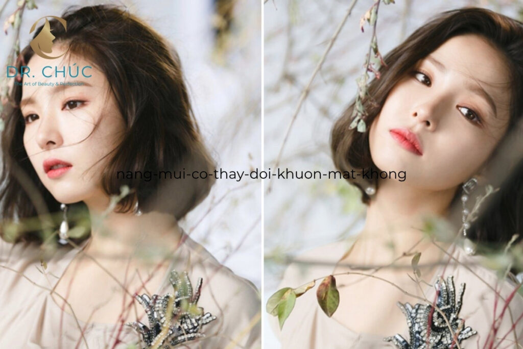 Hiểu đúng về phẫu thuật nâng mũi