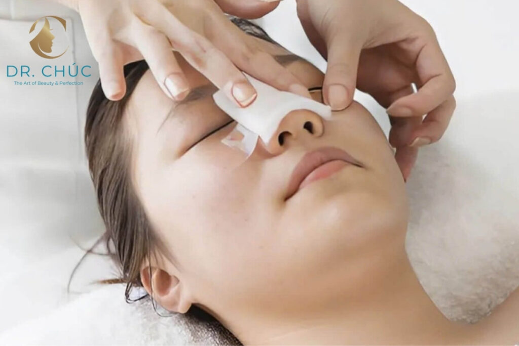 Quy trình nâng mũi S Line chuẩn y khoa tại Bác sĩ Chúc