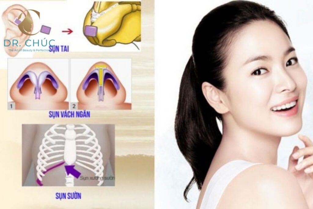 Mối quan hệ giữa sụn mũi và chế độ dinh dưỡng