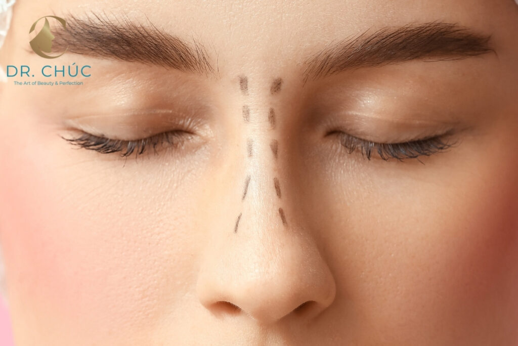 Cảm giác trong quá trình cân chỉnh cánh mũi