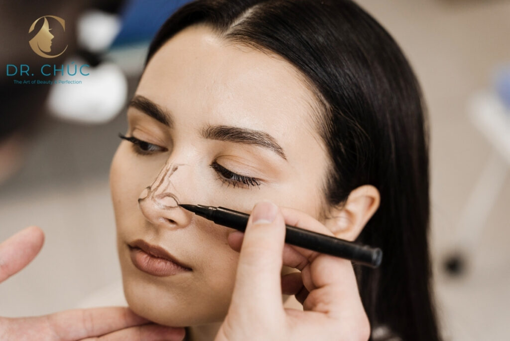 Cân chỉnh cánh mũi là gì và vì sao ngày càng được ưa chuộng?