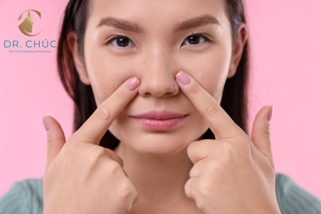 Lợi ích của nâng nền cánh mũi khi thực hiện đúng kỹ thuật