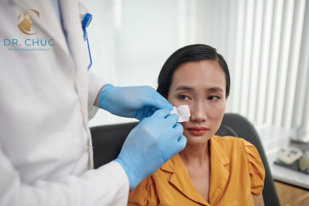 Có nên nâng nền cánh mũi không? Kết luận cuối cùng