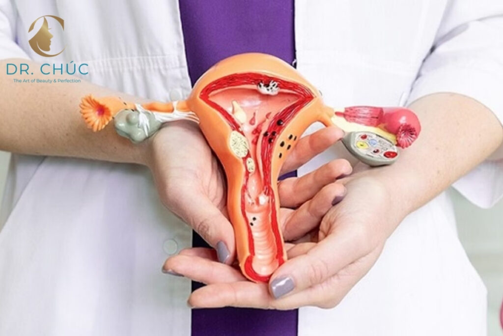 Những bệnh phụ khoa thường gặp ở nữ giới