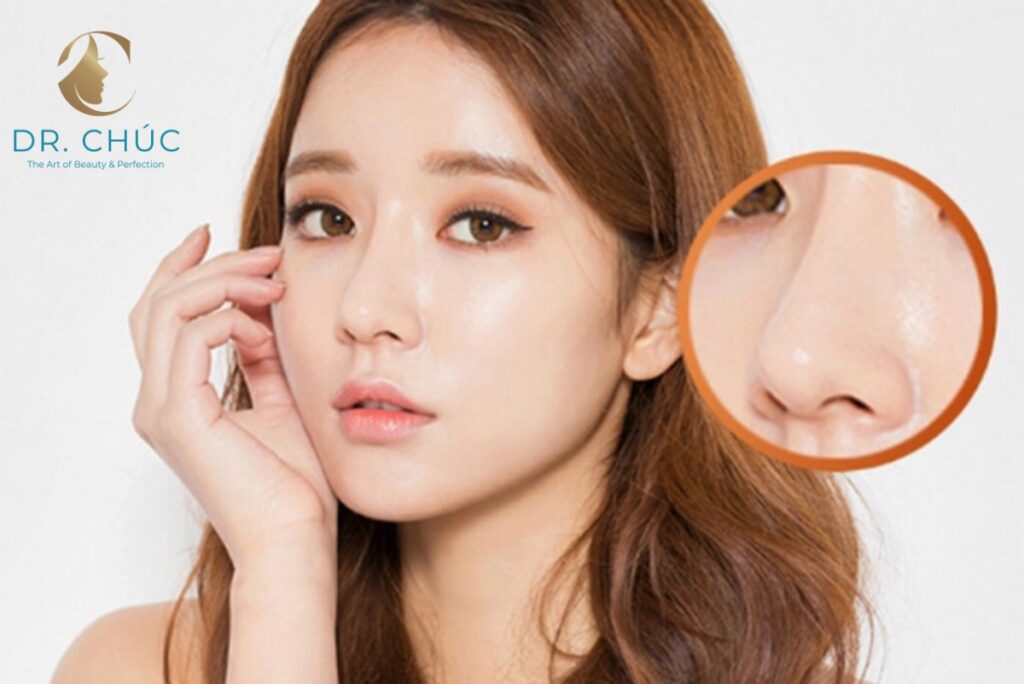 Cách phòng tránh tình trạng nâng mũi bị đỏ đầu mũi