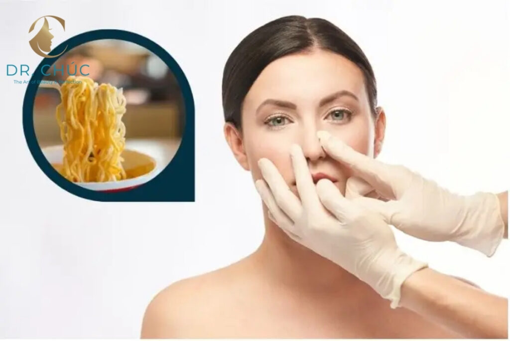 Hiểu đúng về tác động của mì tôm đối với người vừa nâng mũi