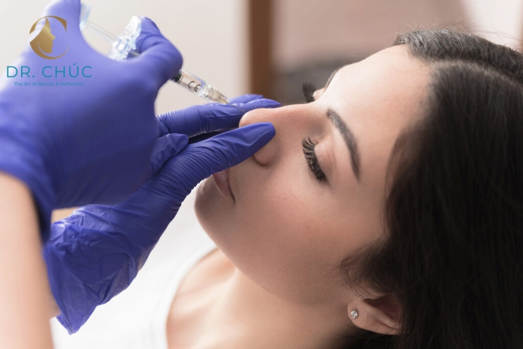 Các phương pháp nâng nền cánh mũi từng phổ biến trước đây