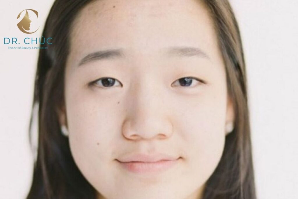 Góc nhìn nhân tướng học về mũi tẹt