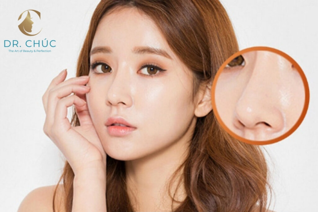 Nhiễm trùng vết thương