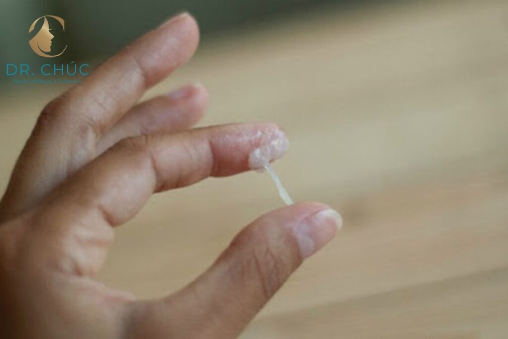 Dịch tiết âm đạo bất thường – cảnh báo rõ ràng từ tử cung