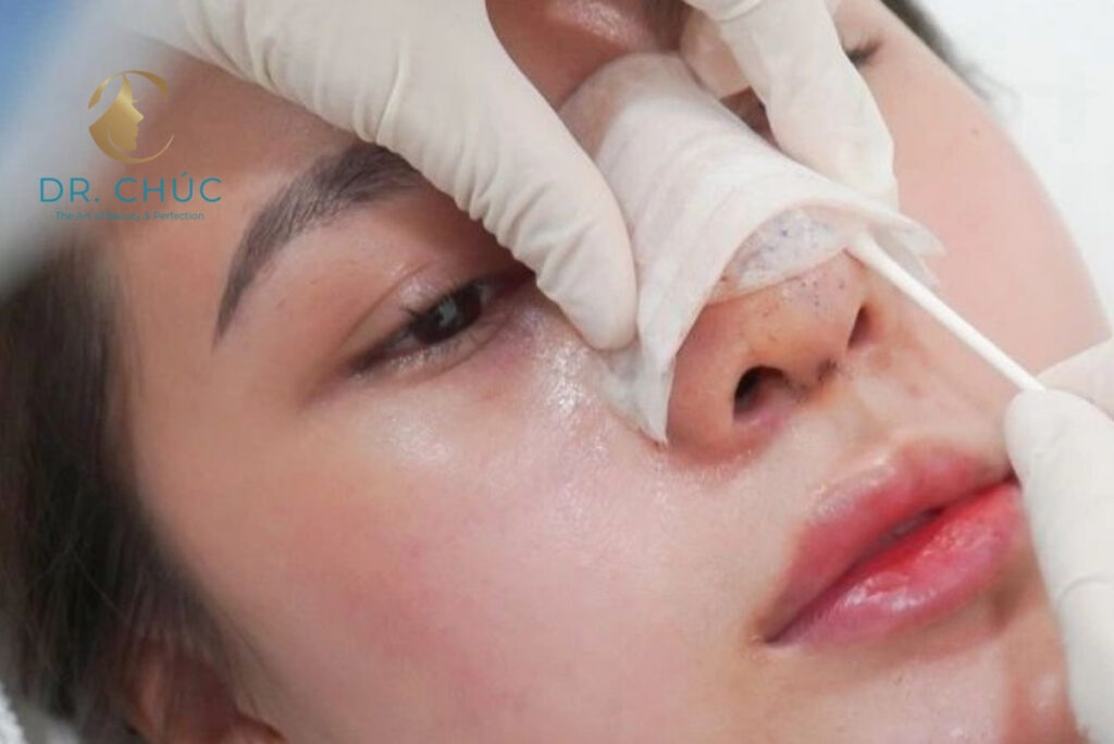 Nâng mũi bị hở vết thương có nguy hiểm không?