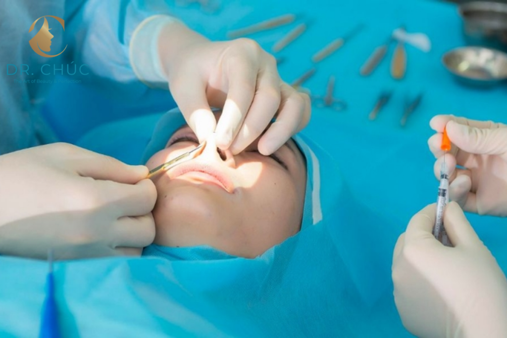 Nguyên nhân khiến nâng mũi bị lệch vách ngăn