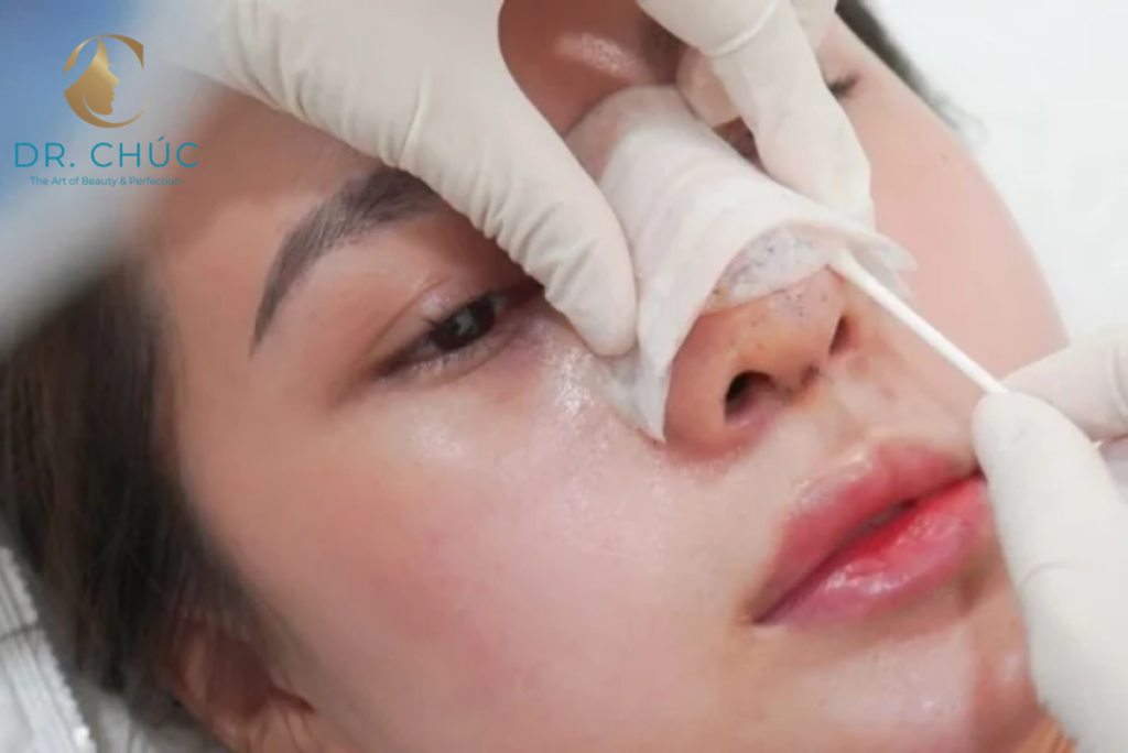 Khi nào cần chỉnh sửa lại mũi?