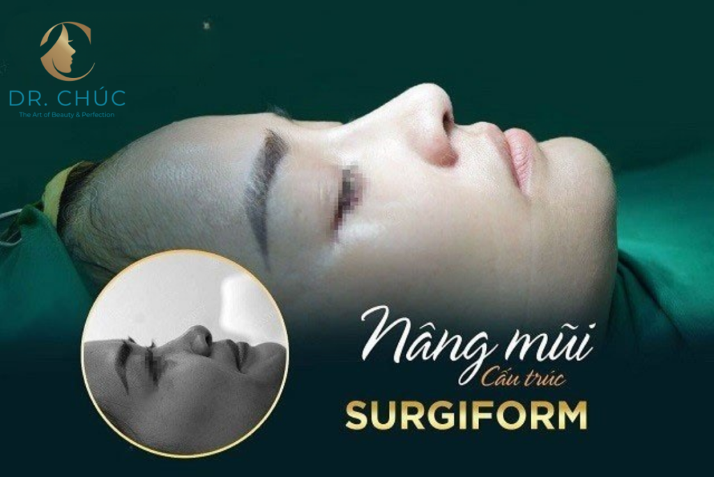 Nâng mũi Surgiform bao nhiêu tiền?