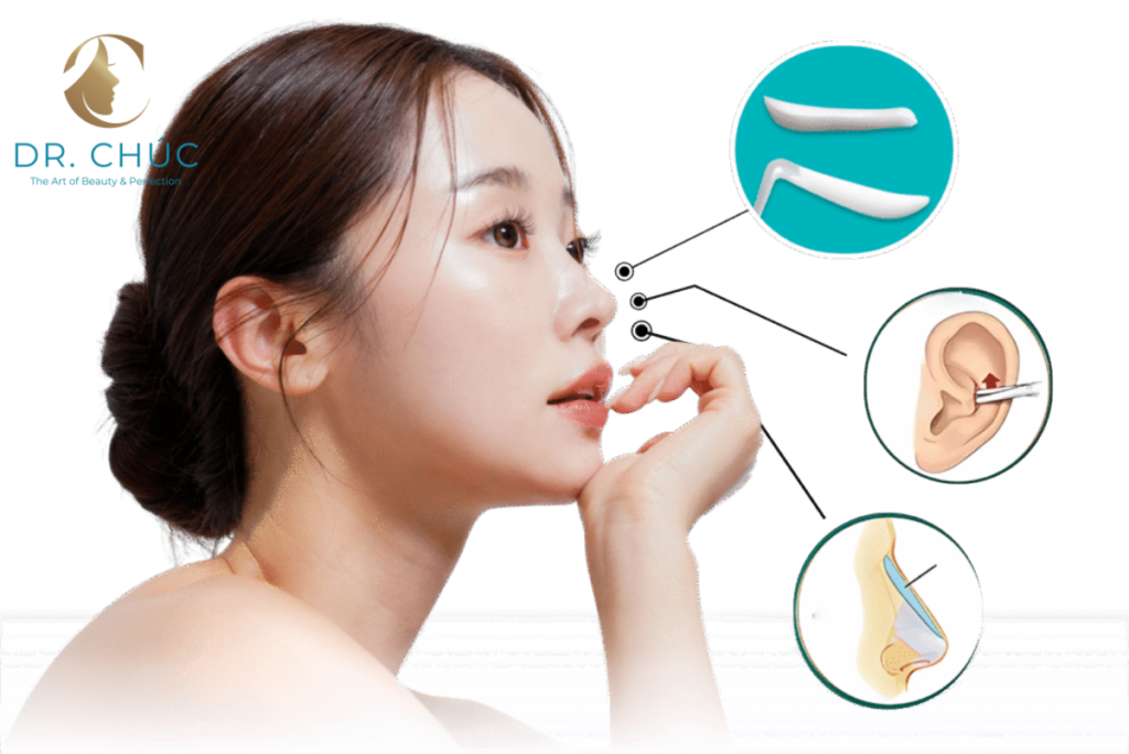 Vì sao nên thực hiện Nâng mũi Surgiform với bác sĩ chuyên sâu?